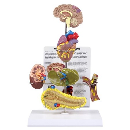 GPI ANATOMICAL Anatomical Model - Metabolic Syndrome 4020